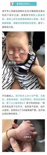 触目惊心十几个月大的孩子几乎毁容事发前去了这个地方