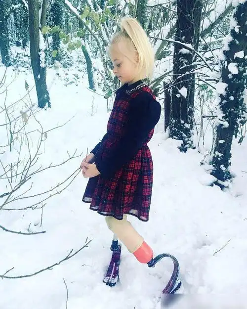 太励志!英国双腿截肢9岁女孩成童模,将亮相纽约时装周