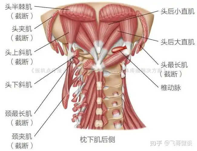 头疼失眠,有可能是你的扳机点失调了