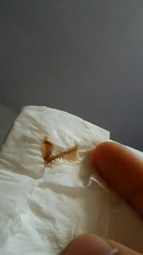 白带带血原因主要分两种情况生理性和疾病性1一般来说女性在排卵期有