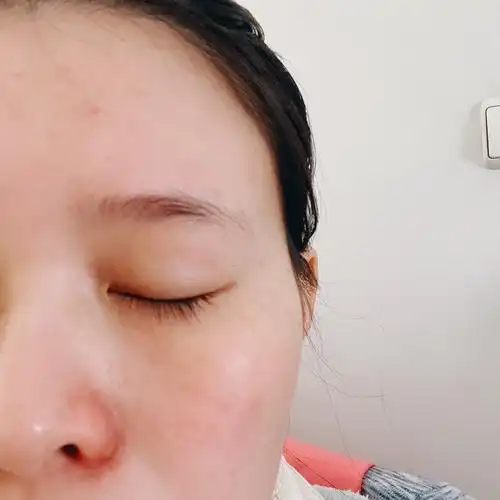 天然的双眼皮闭眼睛