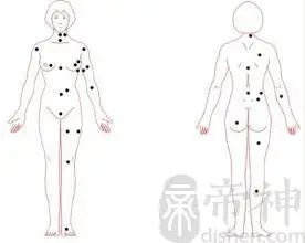 女性后背上的痣与命运有什么关联