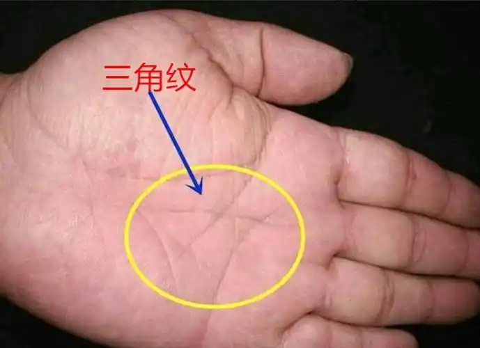 拥有三角纹,不愁吃与穿,早晚可富贵