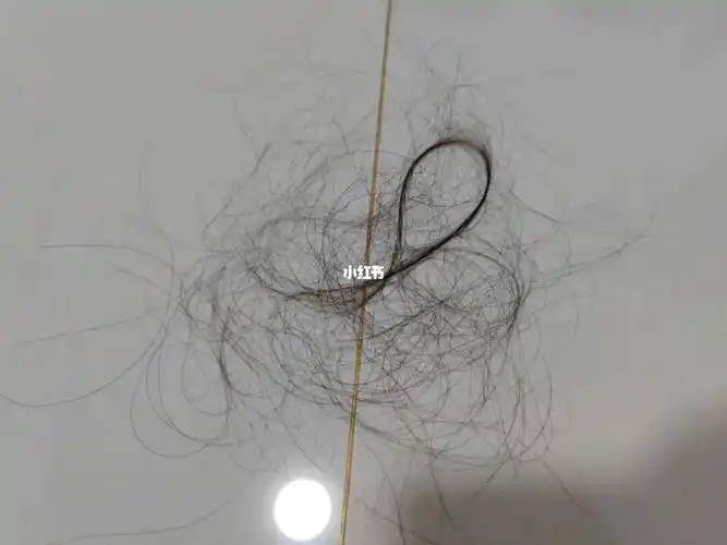 我感觉我快秃了吹个头发掉一堆