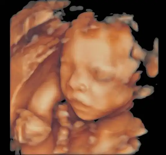 做四维别光"看脸",这几个重要数据暗示了胎儿的秘密.