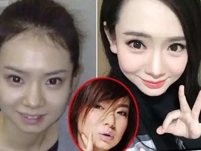 戚薇也是一个精致的大美人,却执着于割双眼皮,导致越来越宽,肉条感也