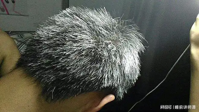 拔一根白头发真的会长十根吗