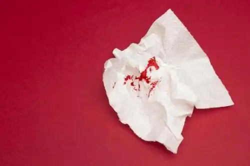 5个"不寻常"的症状出现,女人要警惕宫颈癌,特别是第3个