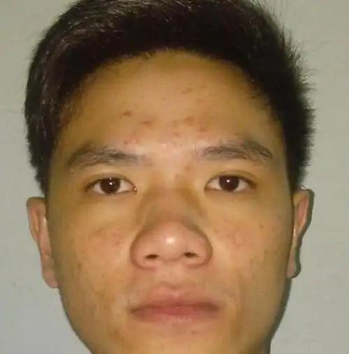 "天生穷命"的男人面相,必定一生孤苦无依,出不完的苦中苦