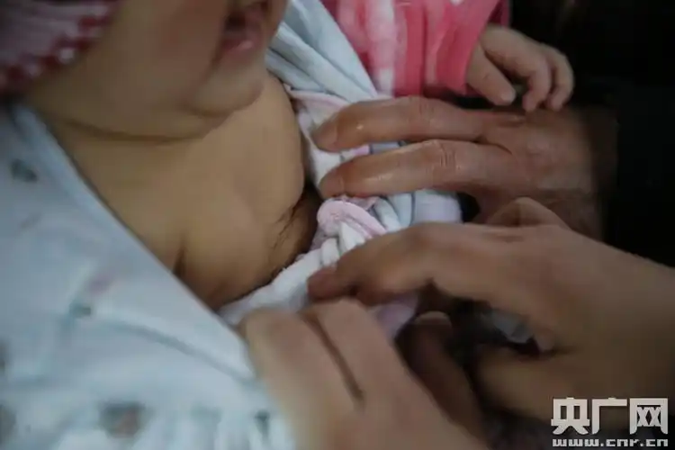 五个月女婴乳房"发育" 专家称不一定与奶粉有关