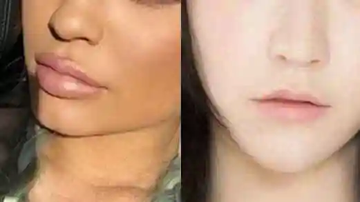 让嘴唇变薄的自然方法有哪些优质