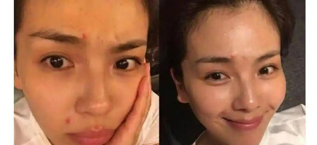 这主要是因为她化妆台多的原因,导致皮肤不怎么好了,看了刘涛卸妆前后