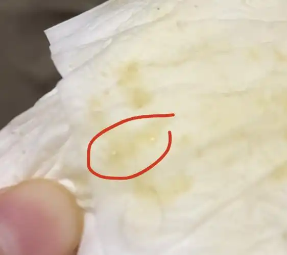 但是昨天它尿完给它擦屁股发现纸上有小结晶,不知道是它尿里的还是