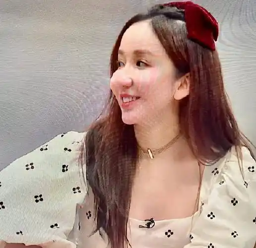 32岁娄艺潇未修图曝光,脸部僵硬疑似整容后遗症_类节目_专业_竞技