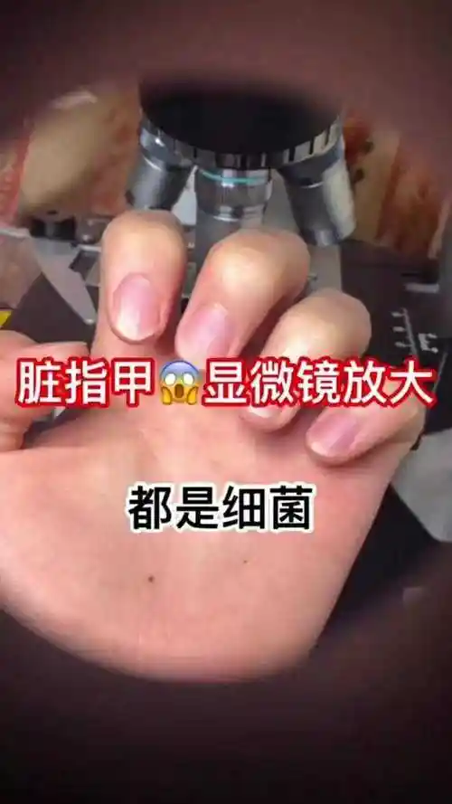 指甲放大后居然有这么多细菌可怕
