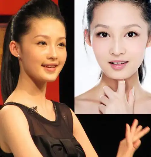 李沁整容前什么样子 李沁整容前后对比照片