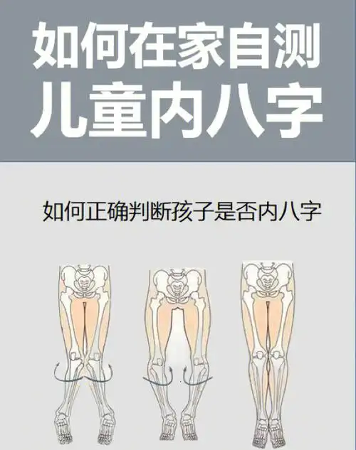 如何自测宝宝是否内八字