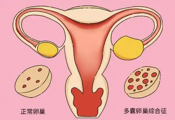 女人摘掉子宫后,与正常女性有什么差异?医生道出大实话