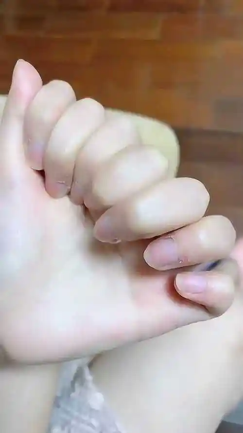 从小长了8根手指头,同学们都笑话我!