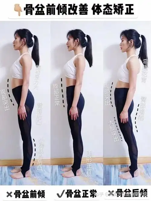01 怎么分辨"骨盆前倾"人体的最佳理想体态从侧面看,画一条垂直线的话