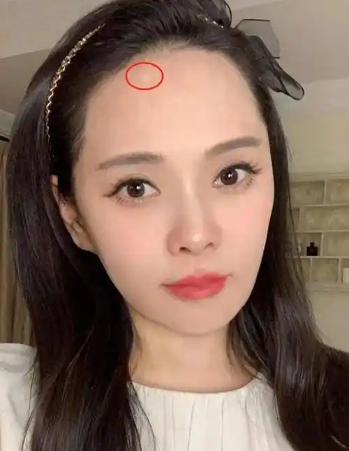 伊能静首曝额头疤痕由来,否认是整容后遗症,大方承认割过双眼皮_父亲