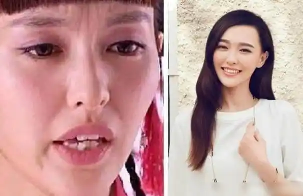 明星整牙如整容她一口牙竟然消费300万网友嘴里藏着一套房