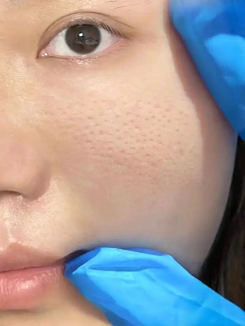 讲真话……收缩毛孔真的90!知道这个方法后,就坚持在用,看到 - 抖音