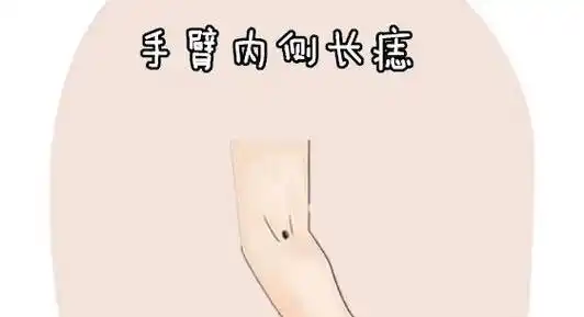 痣相图解大全手臂内侧(痣在手臂上的位置所代表的意义)