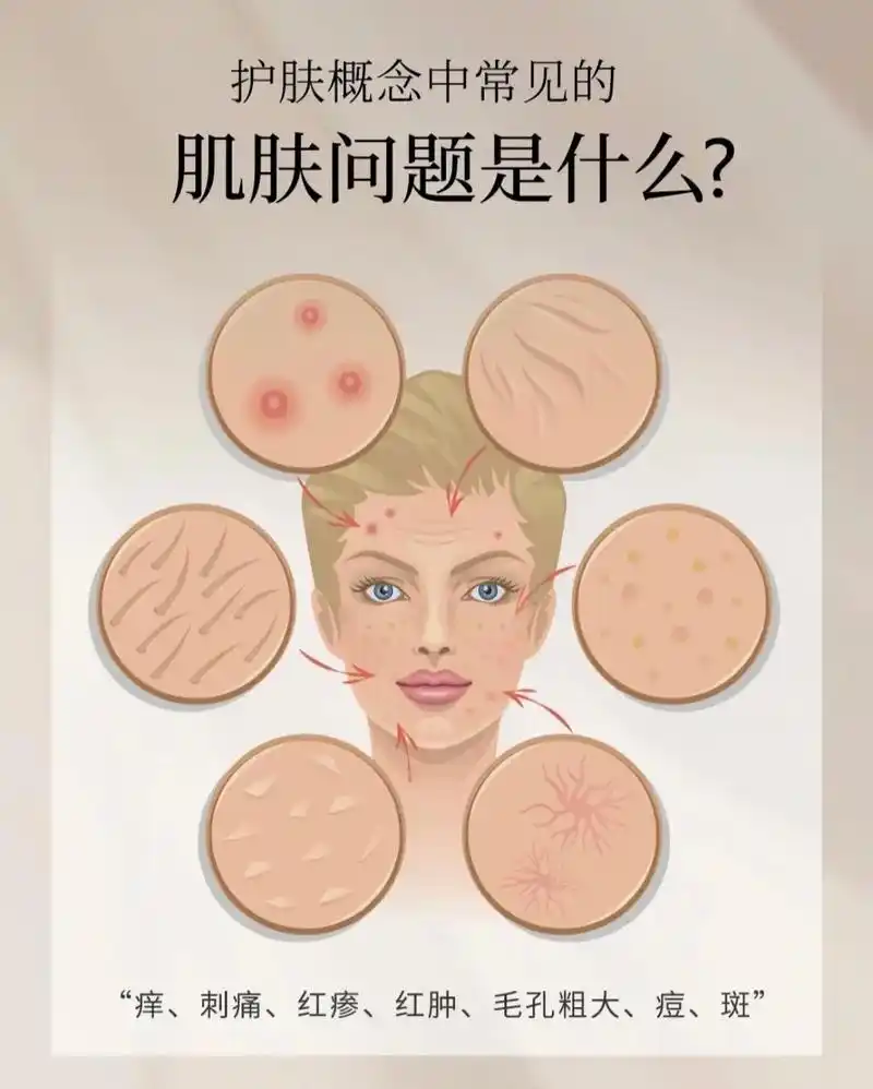 美业|皮肤常见的肌肤问题有哪些?护肤概念中常见的 "痒" " - 抖音