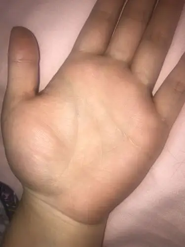 生命线断开了,会看的帮我指点指点呗,婚姻和事业怎么样.