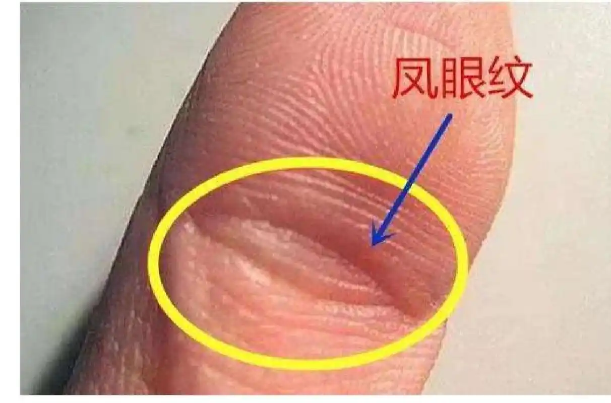 "凤眼纹",既幸福美满,又能旺夫益子 大拇指的第一指节有2条或者3条的