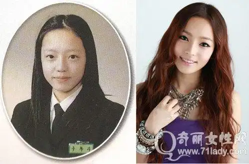 具荷拉整容前后对比照片