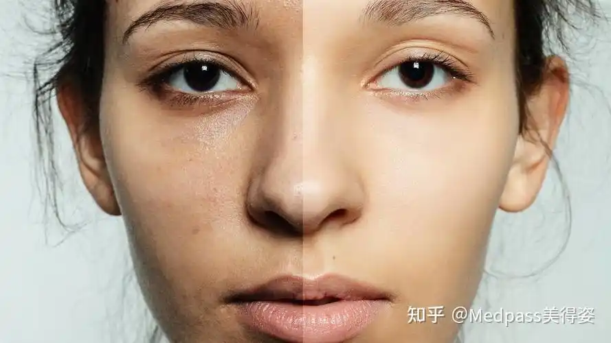 你不是黑黢黢是需要改善皮肤暗沉