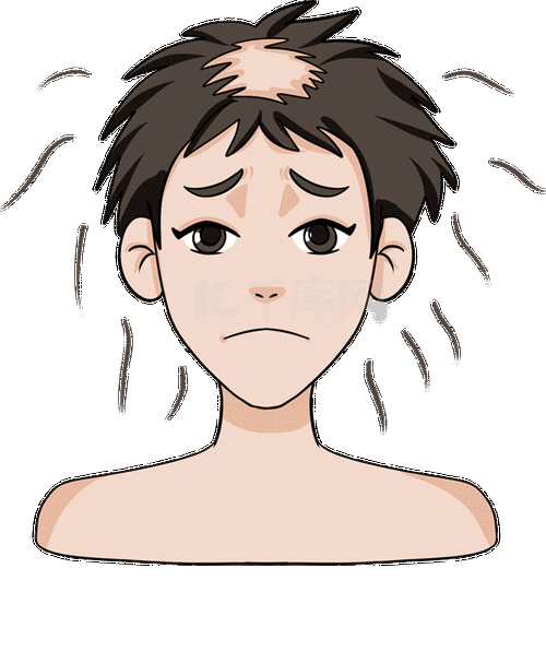 脱发掉发秃头地中海头发掉落男性动图gif