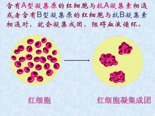 同名凝集原与凝集素相遇时(如a型凝集原和抗a凝集素)会发生红细胞凝集
