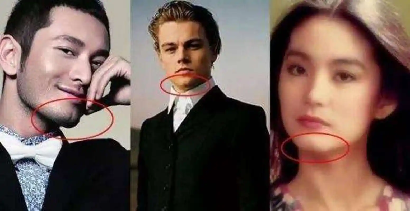 w型下巴,俗称美人沟下巴