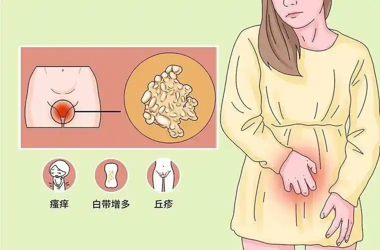 尤其是长这样的…_外阴_症状_位置