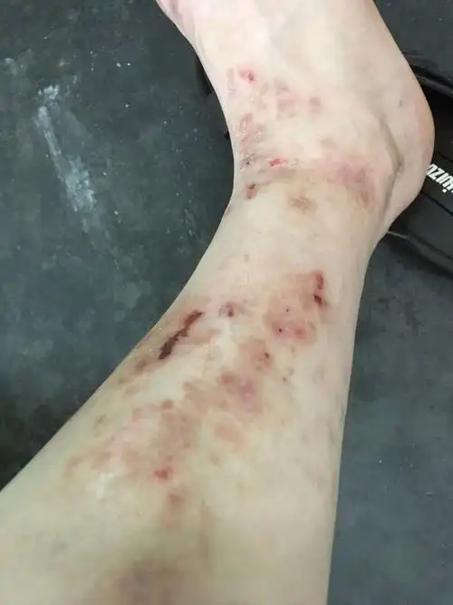 那位大师知道我这腿上是怎么回事吗?