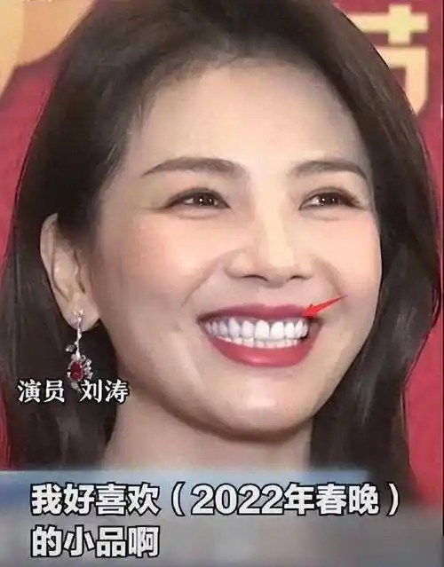 刘涛一口蓝牙上热搜,网传值300万,网友调侃:这牙能连接音响_文章_牙齿