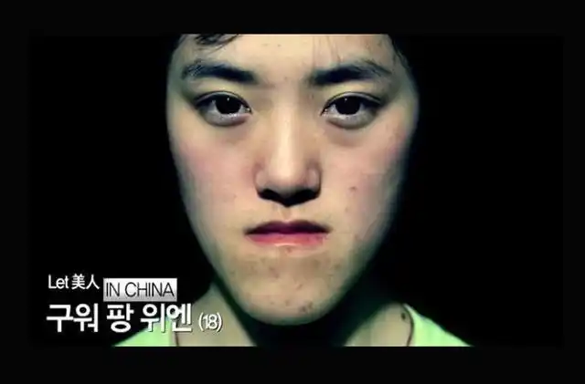 韩国整容真人秀let美人节目惊呆网友