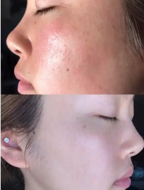 有哪些适合敏感肌的洗面奶好用到飞起