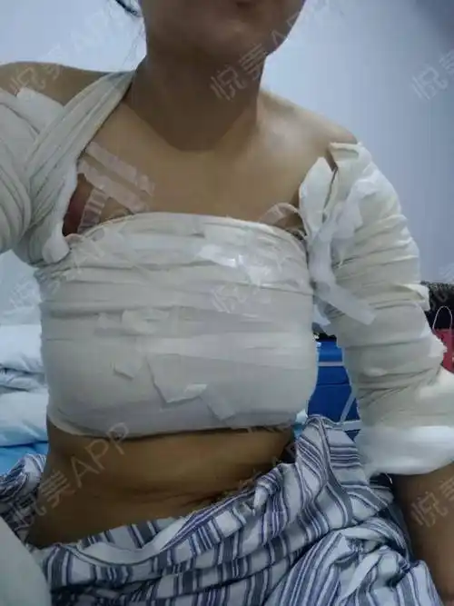 大多时间还是躺着看天花板的,等时间慢慢流逝.