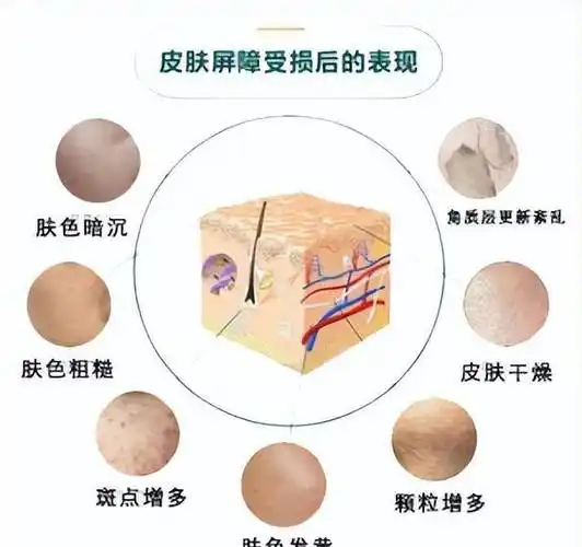 皮肤屏障受损有4个主要症状,皮肤敏感的姐妹们已经踩过一些了!
