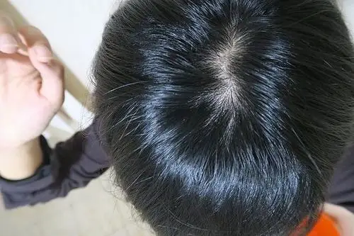 有了【syoss丝蕴无矽灵强健发根洗发乳】,我就有蓬松健康的头发啦!