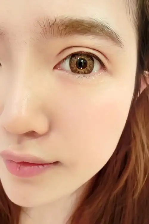 欧式平行双眼皮你真的合适吗?-非常爱美