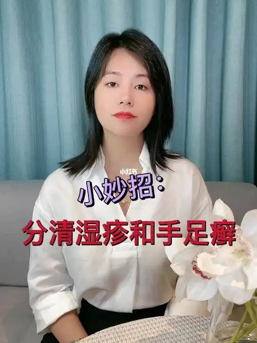 湿疹和手足癣你分得清吗