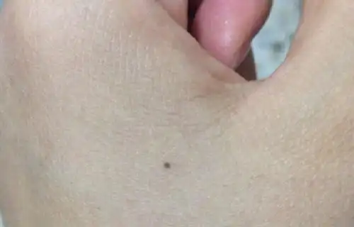 女人左手虎口有痣图解寓意 女人左手虎口有痣旺夫_奇库网