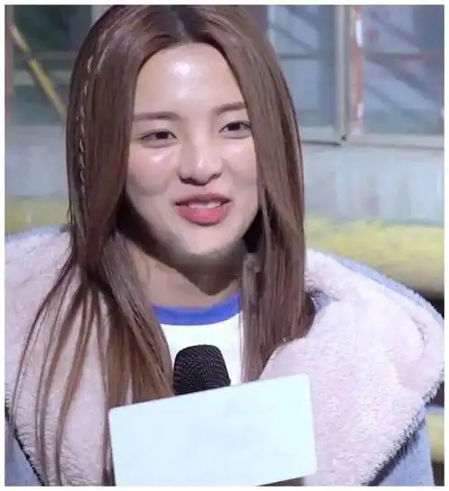 杨超越的脸怎么了?苹果肌肿胀又油腻,近景怼脸拍一言难尽