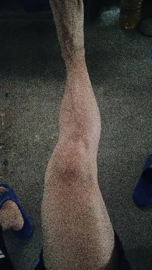 腿弯成这样.正常吗_百度知道