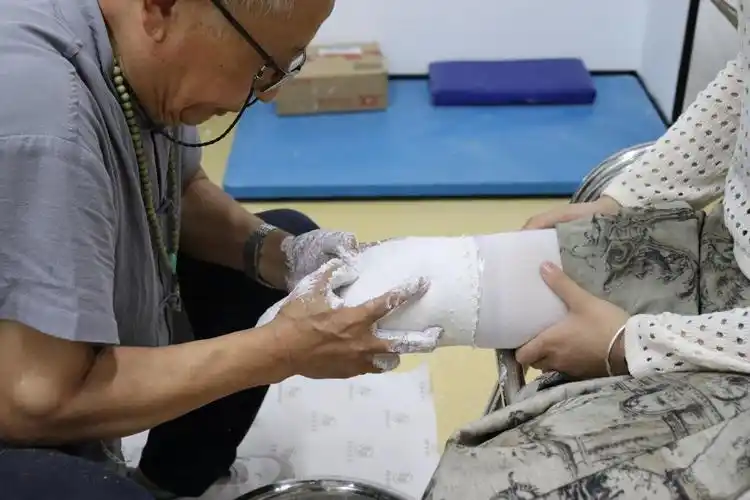 假肢制作过程大揭秘你想知道的都在这